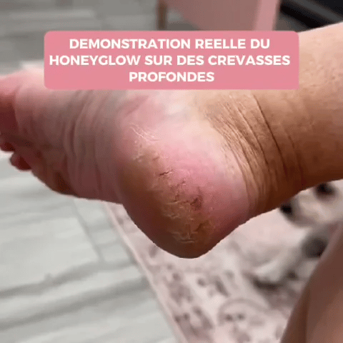 ✨ HoneyCare™ – Kit Beauté Pieds