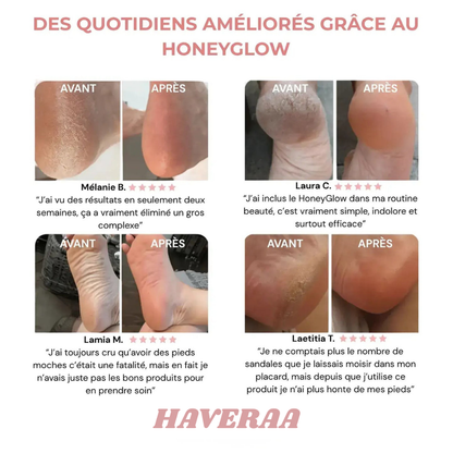 ✨ HoneyCare™ – Kit Beauté Pieds